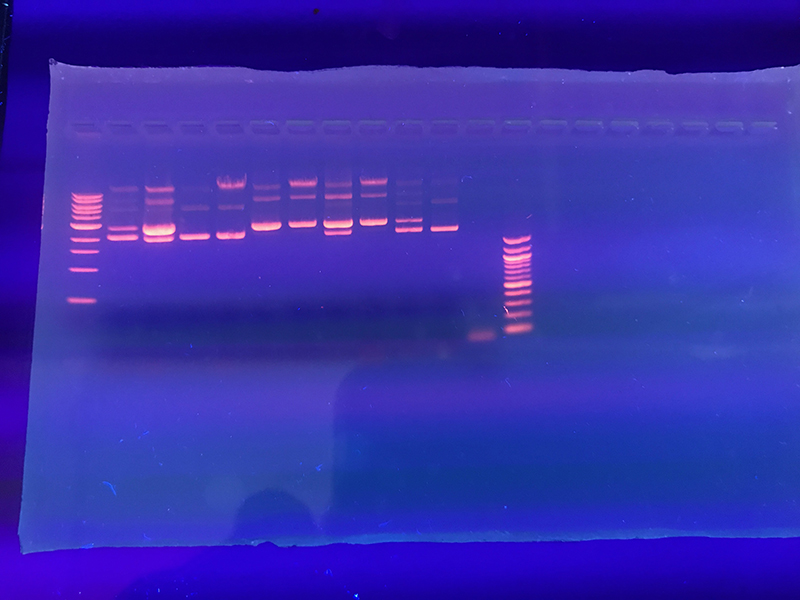 electrophoresis gel under UV light